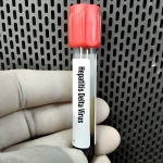 Epatite Delta, approvato negli Stati Uniti il primo trattamento specifico: perch� Hepcludex pu� cambiare la cura di una malattia rara e grave